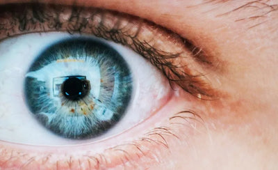 What are iris contact lenses? Professional explanation